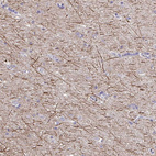 Anti-NEFH Antibody