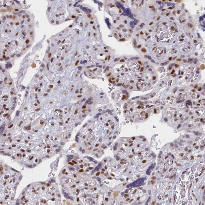 Anti-GTF2B Antibody