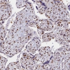 Anti-GTF2B Antibody