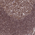 Anti-GTF2B Antibody