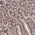 Immunohistochemical staining of human duodenum shows strong nuclear positivity in glandular cells and lymphoid cells.