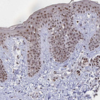 Immunohistochemical staining of human skin shows strong nuclear positivity in squamous epithelial cells.
