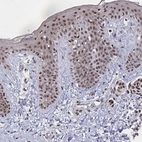 Immunohistochemical staining of human skin shows strong nuclear positivity in squamous epithelial cells.
