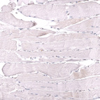 Immunohistochemical staining of human skeletal muscle shows no positivity in myocytes as expected.