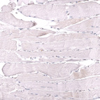 Anti-MSH6 Antibody