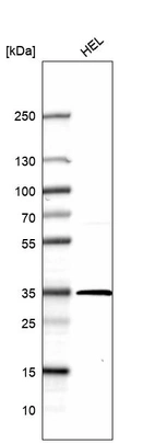 Western blot analysis in human cell line HEL.