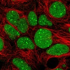Immunofluorescent staining of human cell line HEK 293 shows localization to nucleus & nuclear bodies.