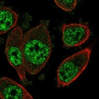 Anti-SOX12 Antibody