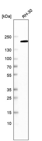 Western blot analysis in human cell line RH-30.