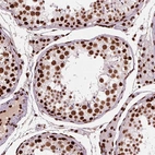 Anti-BRD4 Antibody