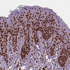 Immunohistochemical staining of human skin shows strong nuclear positivity in squamous epithelial cells.