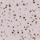 Immunohistochemical staining of human cerebral cortex shows strong nuclear positivity in neurons.