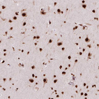 Anti-BRD4 Antibody