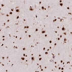Immunohistochemical staining of human cerebral cortex shows strong nuclear positivity in neurons.