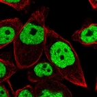 Immunofluorescent staining of human cell line PC-3 shows localization to nucleoplasm.