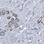 Anti-TAGLN Antibody