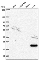 Western blot analysis in human cell line RT-4, human cell line U-251 MG, human plasma and human liver tissue.