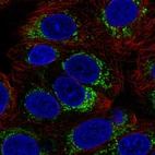Immunofluorescent staining of human cell line MCF7 shows localization to mitochondria.