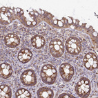 Immunohistochemical staining of human lower gastrointestinal shows moderate to strong granular cytoplasmic positivity in glandular cells.