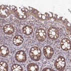 Immunohistochemical staining of human lower gastrointestinal shows moderate to strong granular cytoplasmic positivity in glandular cells.
