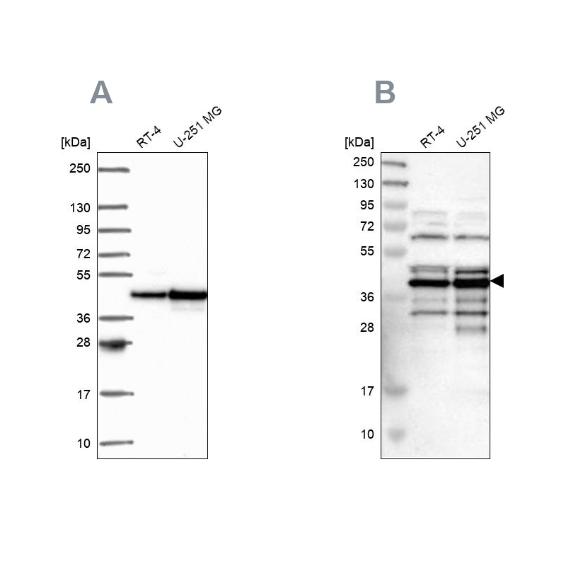 Anti-SLBP Antibody