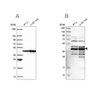 Anti-SLBP Antibody