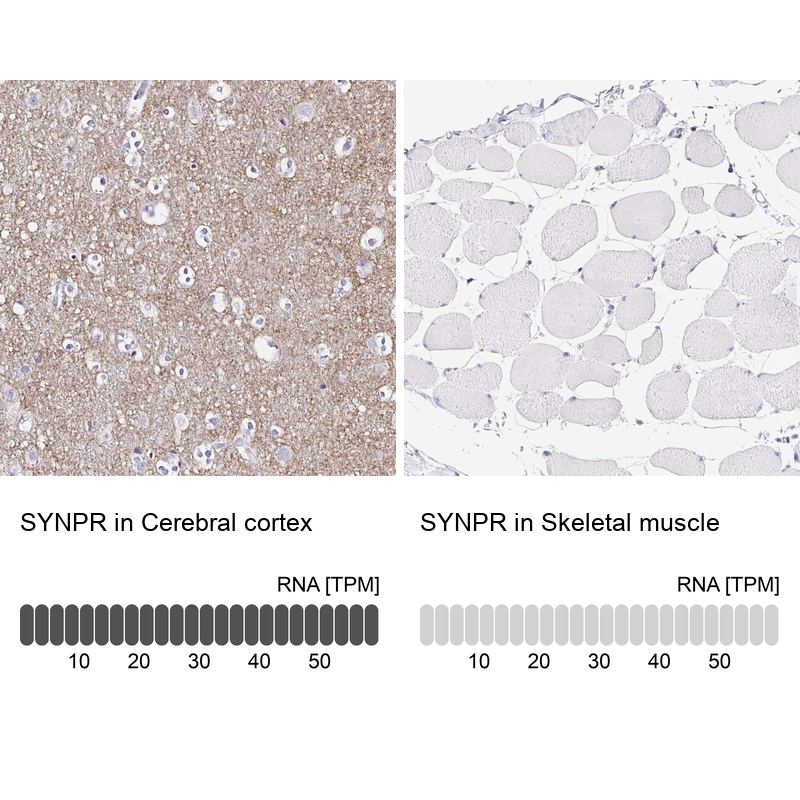 Anti-SYNPR Antibody