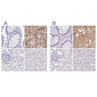 Immunohistochemical staining of human colon, hippocampus, kidney and liver using Anti-SYNPR antibody HPA061671 (A) shows similar protein distribution across tissues to independent antibody HPA051368 (B).