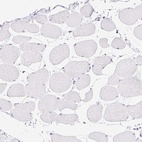 Immunohistochemical staining of human skeletal muscle shows low expression as expected.