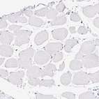 Immunohistochemical staining of human skeletal muscle shows low expression as expected.