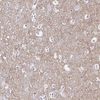 Immunohistochemical staining of human cerebral cortex shows high expression.