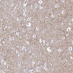 Immunohistochemical staining of human cerebral cortex shows high expression.