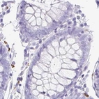 Immunohistochemical staining of human colon using Anti-SYNPR antibody HPA061671.