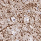 Immunohistochemical staining of human hippocampus using Anti-SYNPR antibody HPA061671.