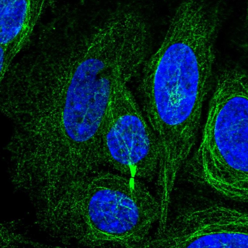 Anti-KIAA1211L Antibody