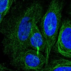 Anti-KIAA1211L Antibody