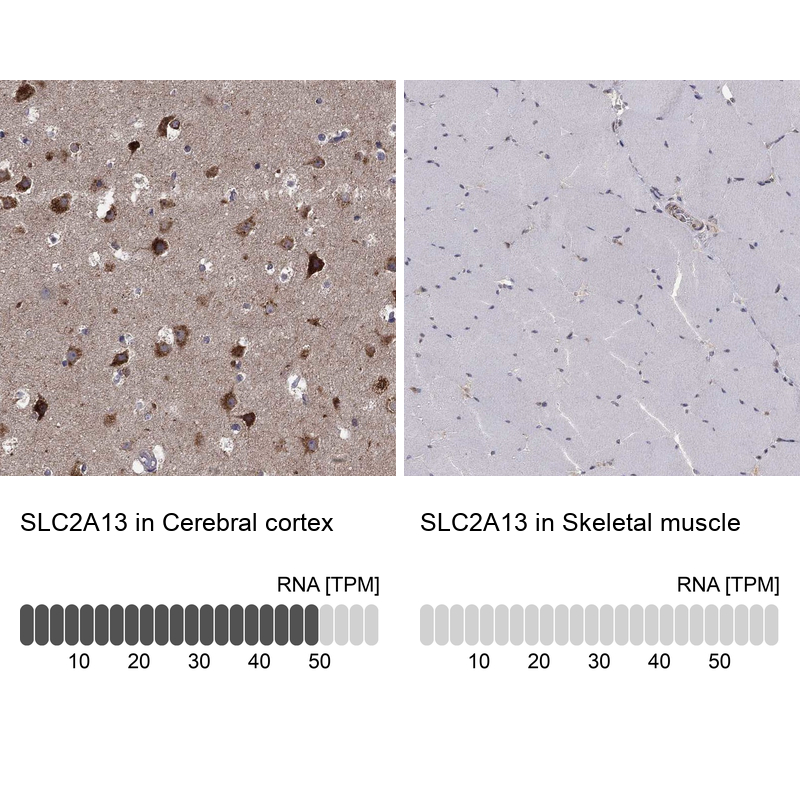 Anti-SLC2A13 Antibody