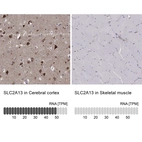 Anti-SLC2A13 Antibody