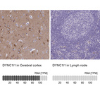 Anti-DYNC1I1 Antibody