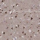 Immunohistochemical staining of human cerebral cortex shows high expression.