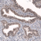Immunohistochemical staining of human fallopian tube shows weak to moderate cytoplasmic and nuclear positivity in glandular cells.