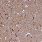 Immunohistochemical staining of human cerebral cortex shows high expression.