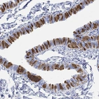 Immunohistochemical staining of human fallopian tube shows high expression.