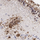 Immunohistochemical staining of human hypothalamus shows strong nuclear and cytoplasmic positivity in glial cells.