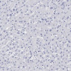 Immunohistochemical staining of human liver shows low expression as expected.