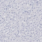 Immunohistochemical staining of human liver shows low expression as expected.