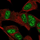 Immunofluorescent staining of human cell line SH-SY5Y shows localization to nuclear speckles.