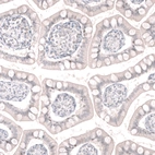 Immunohistochemical staining of human small intestine shows no positivity in glandular cells as expected.