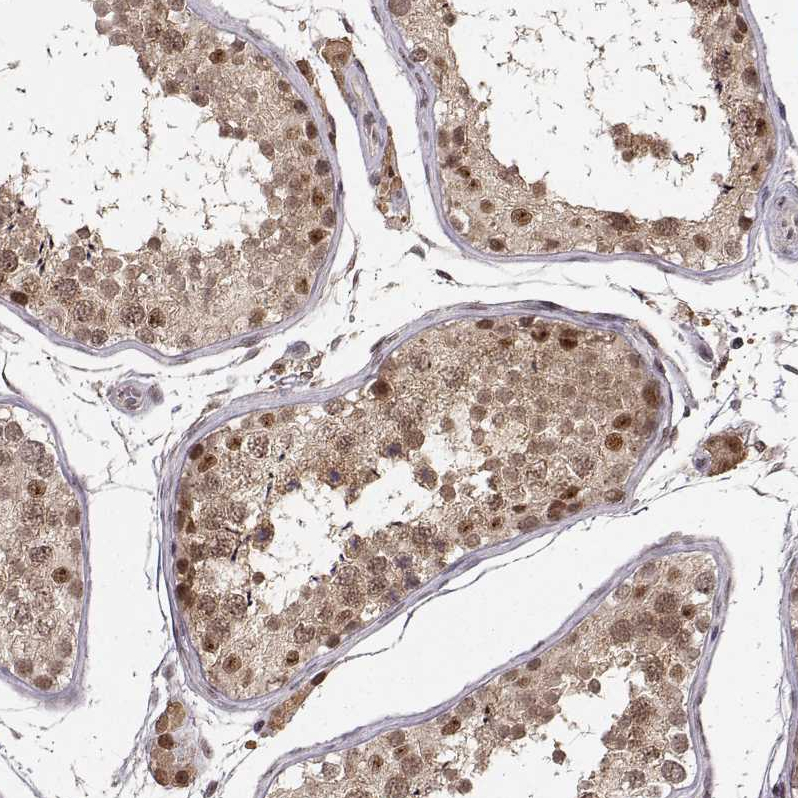 Anti-CSNK2A1 Antibody