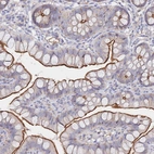 Immunohistochemical staining of human small intestine shows strong membranous positivity in glandular cells.